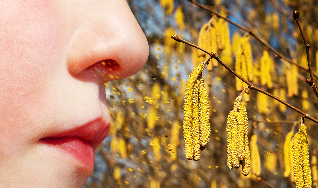 20% de la population est allergique au pollen